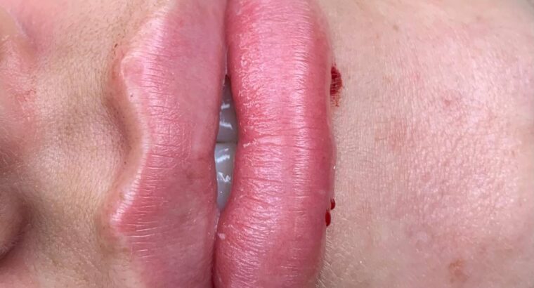 Запрошую Вас до себе на процедури 🌹Madrid Досвідом більше 10 років Буду рада знайомству.