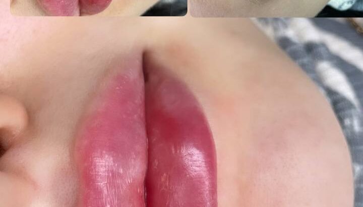 Запрошую Вас до себе на процедури 🌹Madrid Досвідом більше 10 років Буду рада знайомству.