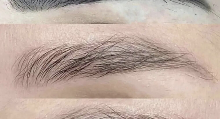 Видалення тату та татуажу