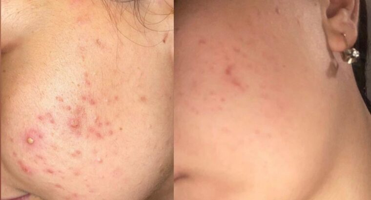 Всем привет! Меня зовут Виктория! Я бьюти эксперт по разбору уходовой косметики 🧴