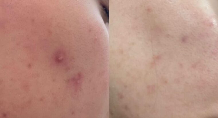 Всем привет! Меня зовут Виктория! Я бьюти эксперт по разбору уходовой косметики 🧴