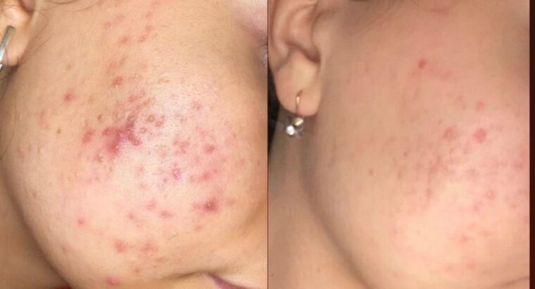 Всем привет! Меня зовут Виктория! Я бьюти эксперт по разбору уходовой косметики 🧴