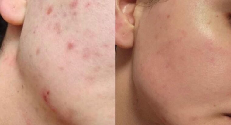 Всем привет! Меня зовут Виктория! Я бьюти эксперт по разбору уходовой косметики 🧴