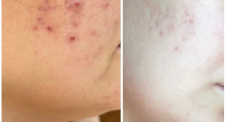 Всем привет! Меня зовут Виктория! Я бьюти эксперт по разбору уходовой косметики 🧴