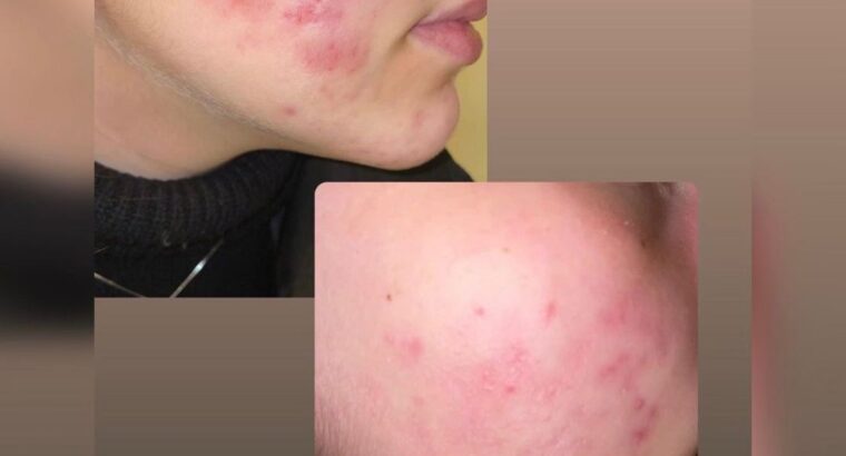 Всем привет! Меня зовут Виктория! Я бьюти эксперт по разбору уходовой косметики 🧴