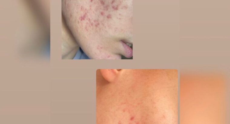 Всем привет! Меня зовут Виктория! Я бьюти эксперт по разбору уходовой косметики 🧴