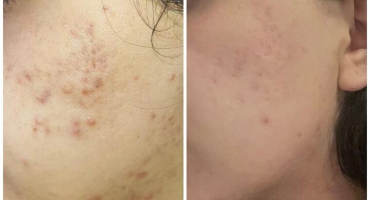 Всем привет! Меня зовут Виктория! Я бьюти эксперт по разбору уходовой косметики 🧴